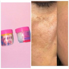 Sunburn remover with spf