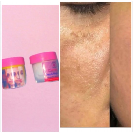 Sunburn remover with spf